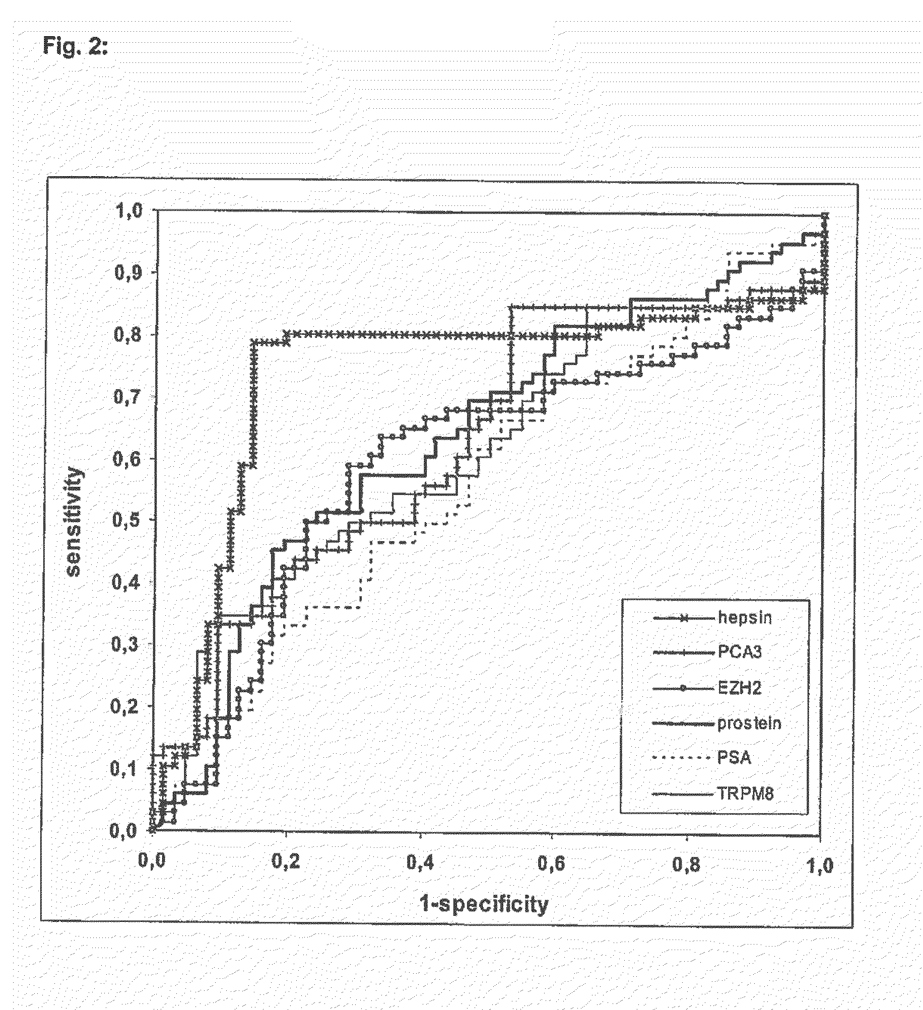 Non-invasive method for diagnosis of prostate cancer