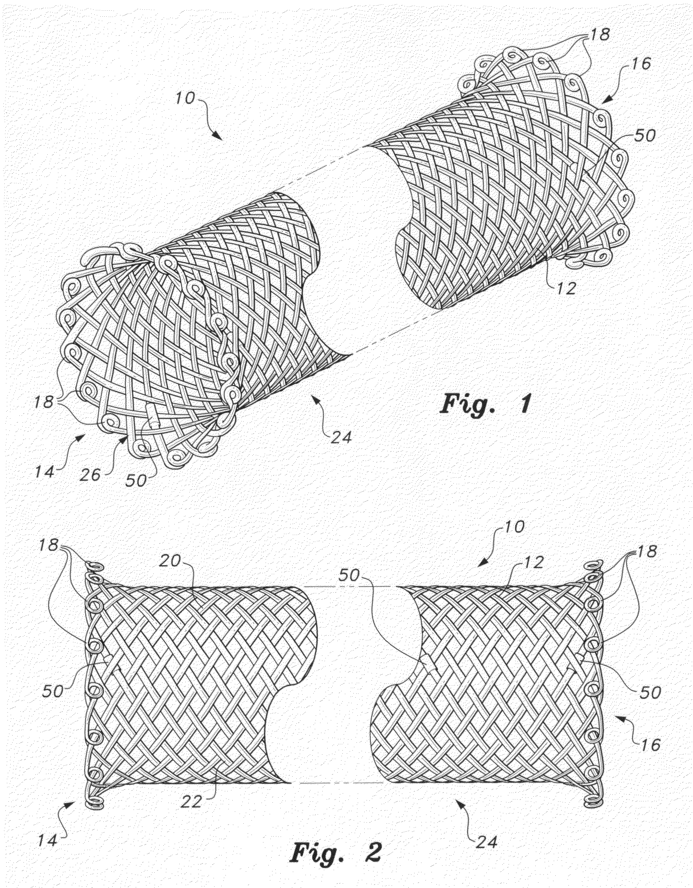 Self-expanding biodegradable stent