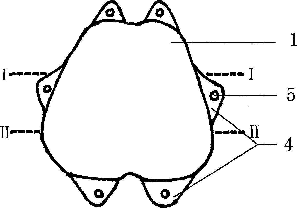 Epidural scar preventing absorbable isolationcapsule