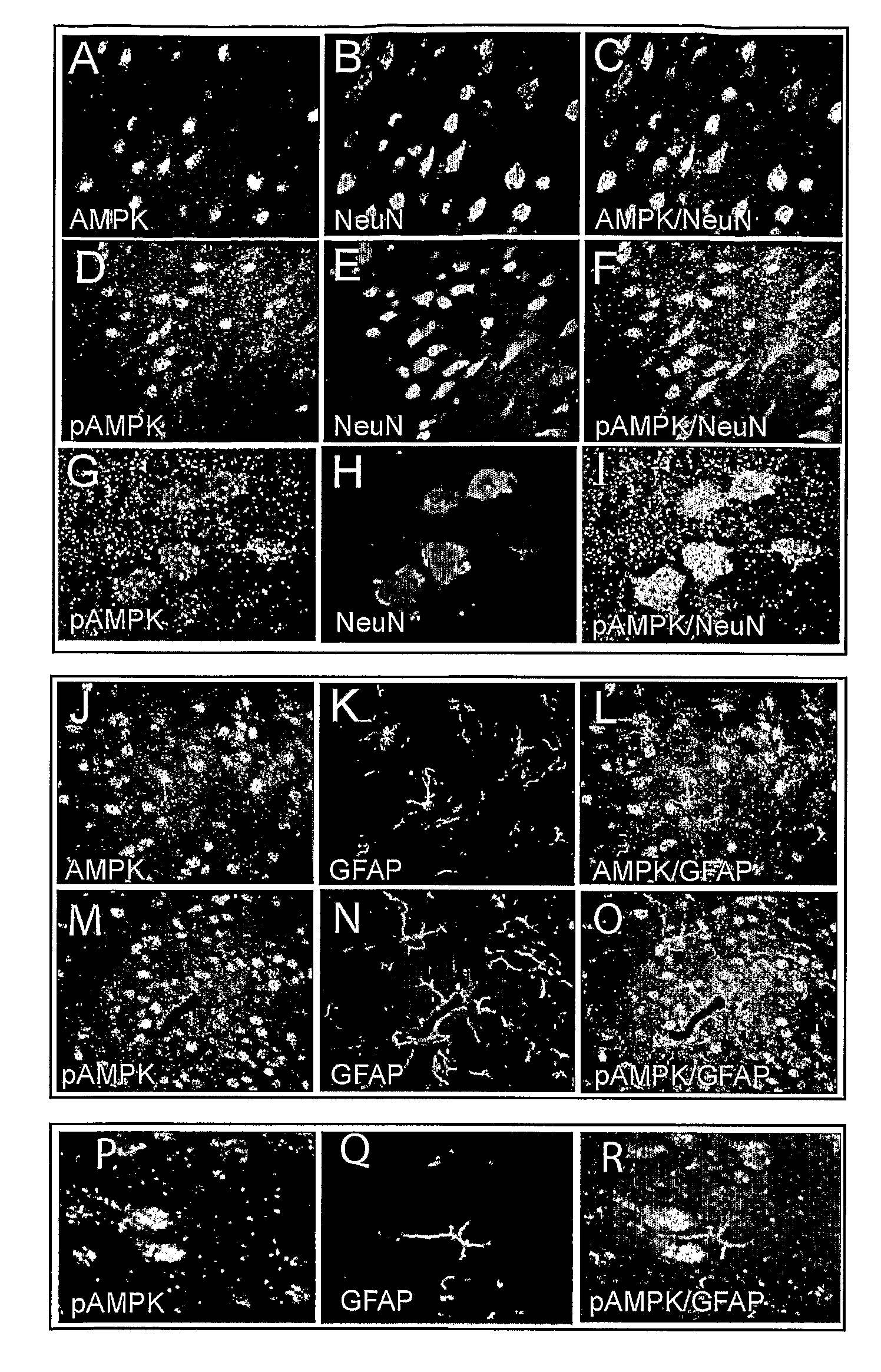 Novel method of neuroprotection by pharmacological inhibition of amp-activated protein kinase