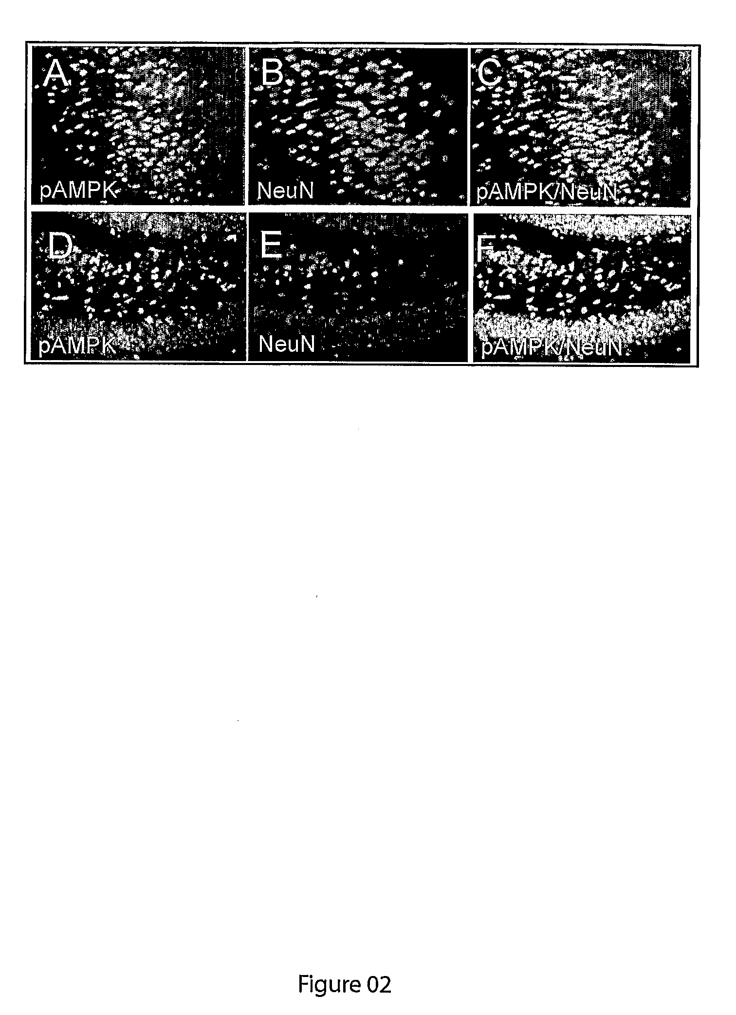 Novel method of neuroprotection by pharmacological inhibition of amp-activated protein kinase