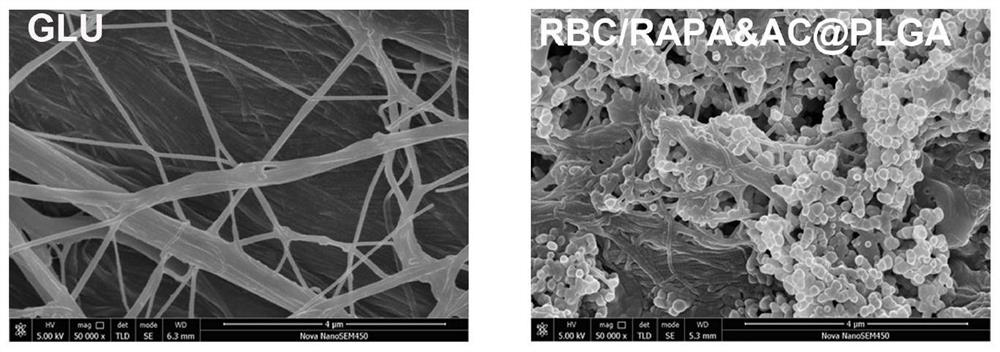 A biomimetic modified valve material and its preparation method and application