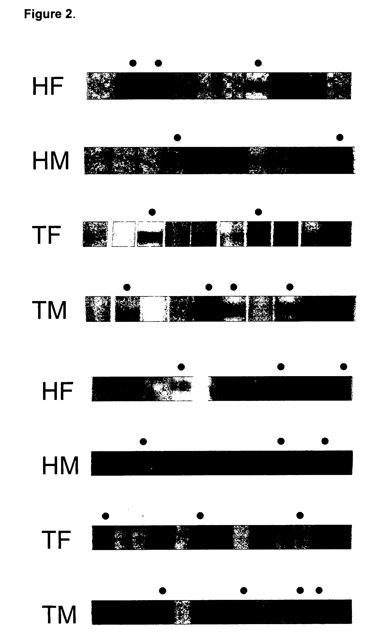 Method of diagnosing myasthenia gravis and kits therefor