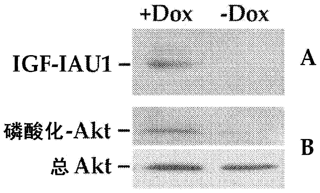 Systemic delivery and regulated expression of paracrine genes for cardiovascular disease and other conditions