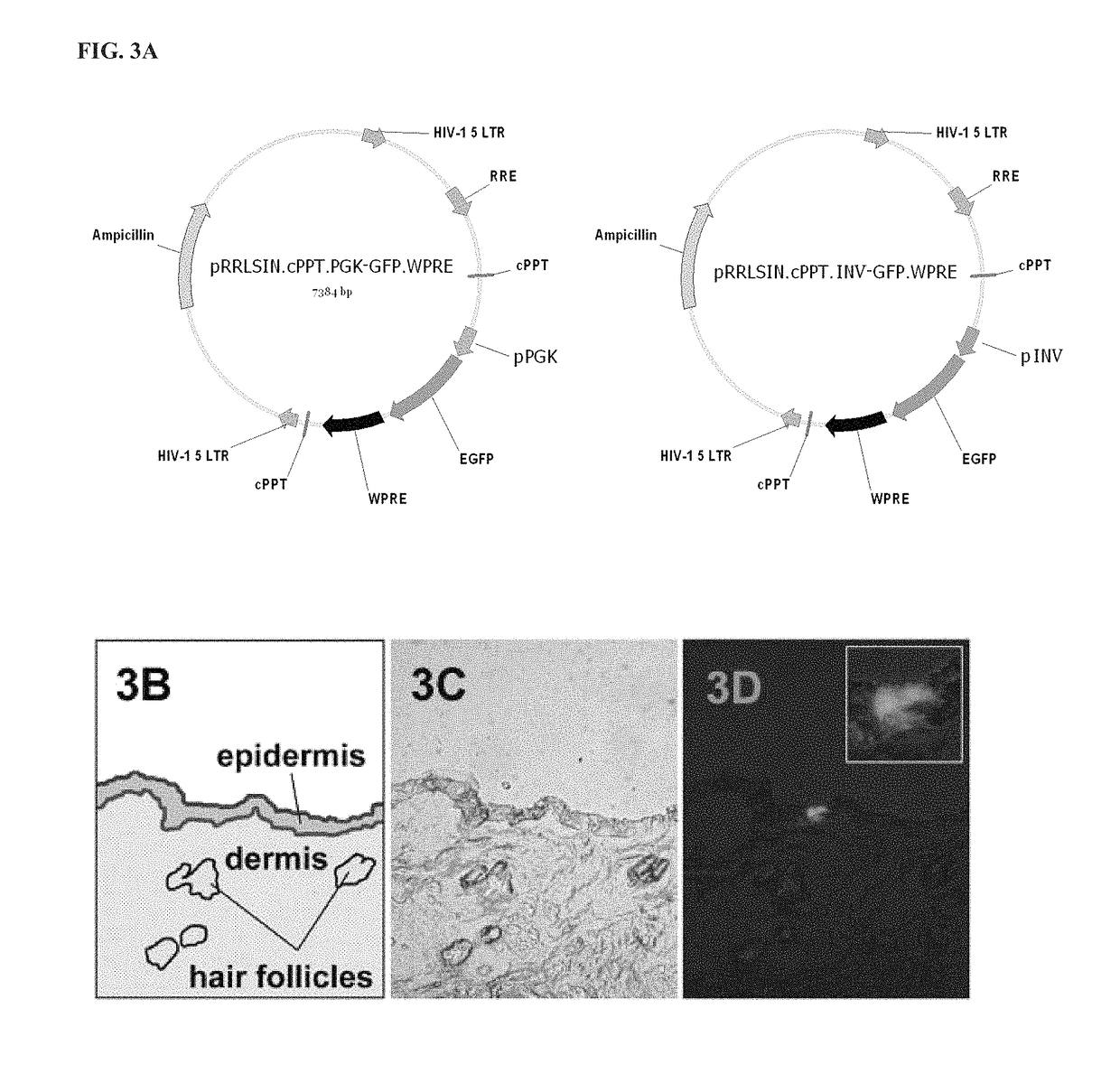 Involucrin-driven retroviral expression cassettes encoding human immunodeficiency virus envelope glycoproteins