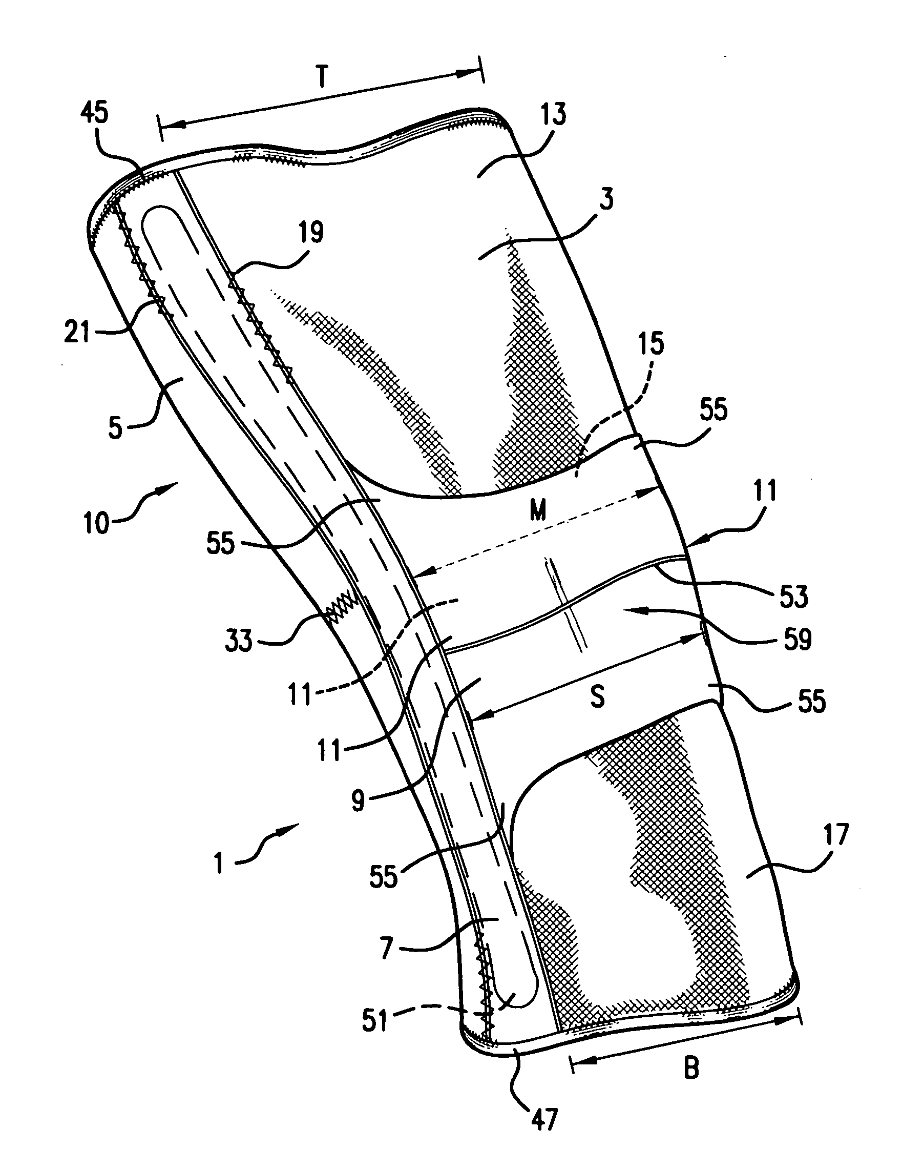 Apparatus for and method of diagnosing and treating patello-femoral misalignment