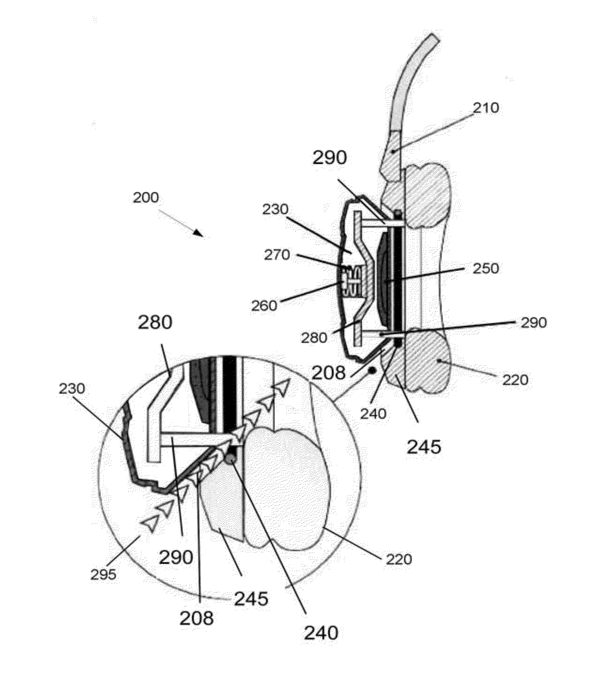 Earphone with toggle mechanism