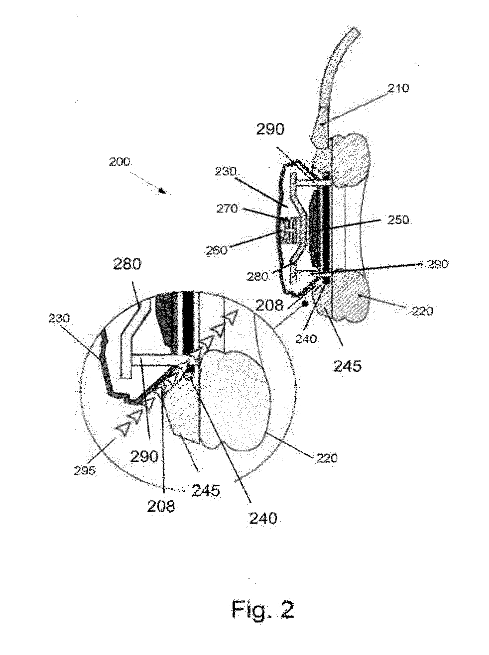 Earphone with toggle mechanism