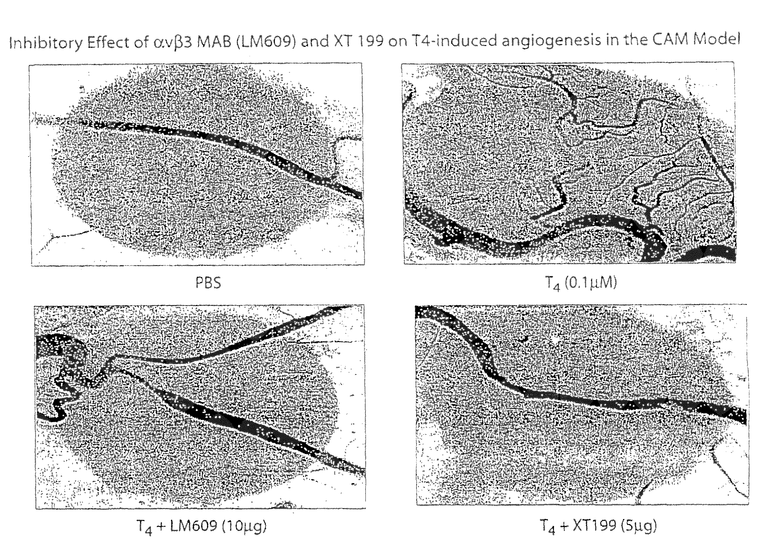 Thyroid hormone analogs and methods of use