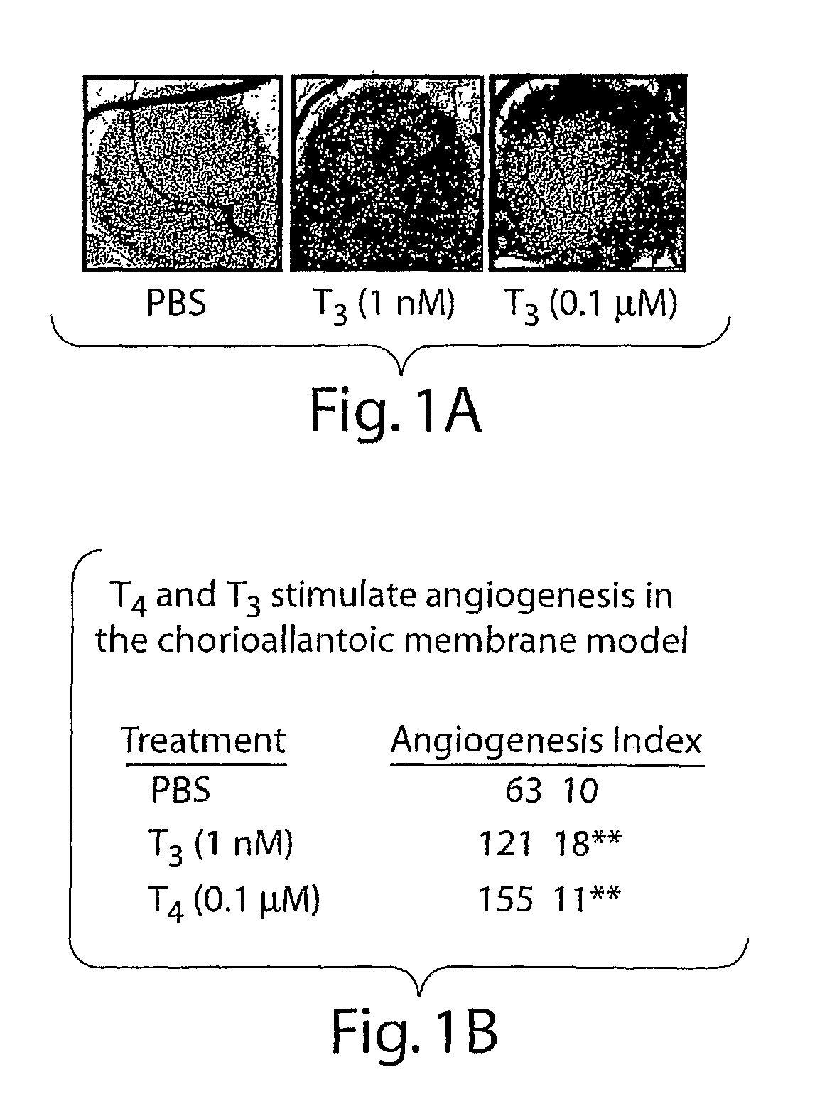 Thyroid hormone analogs and methods of use