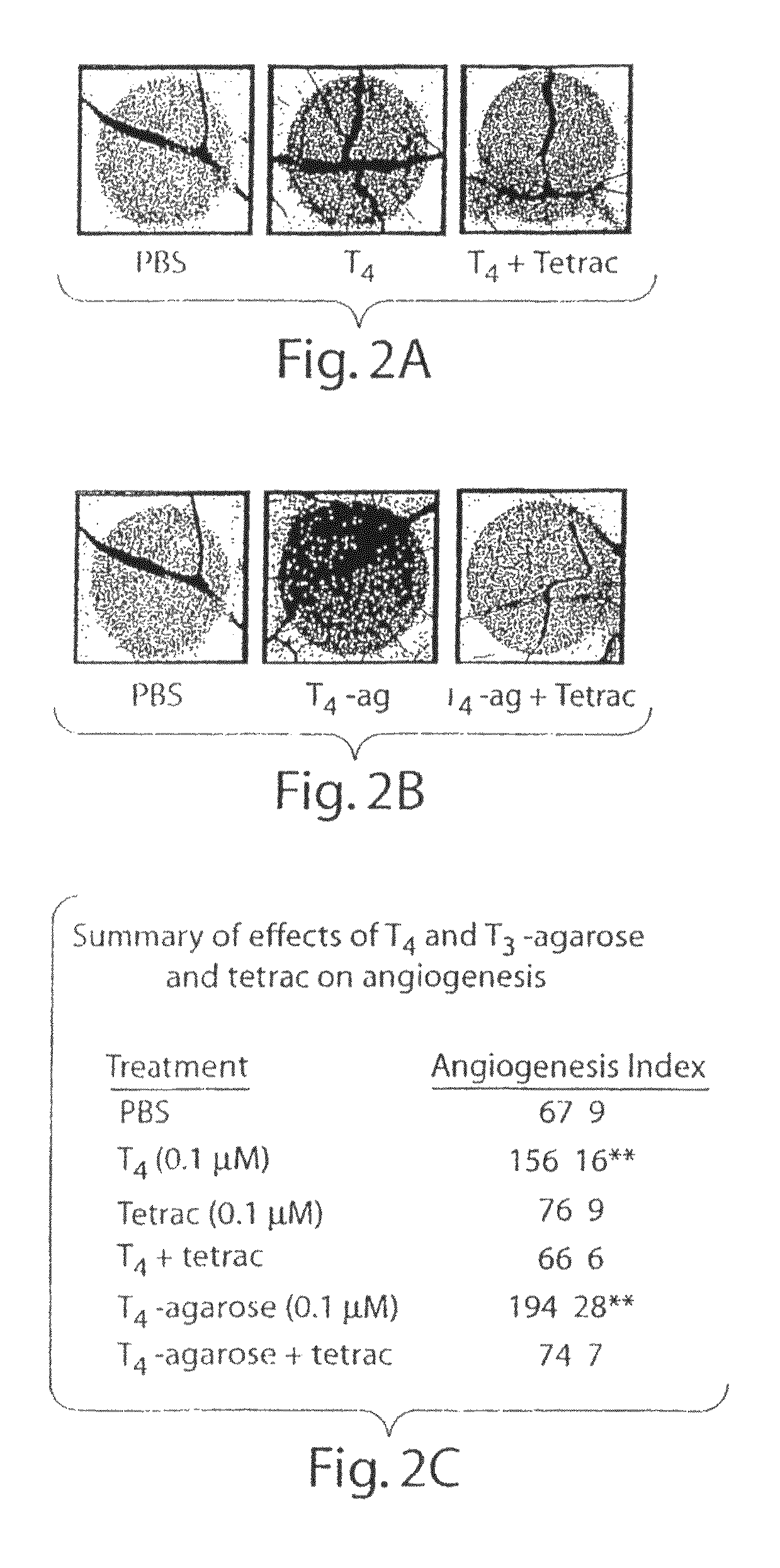 Thyroid hormone analogs and methods of use