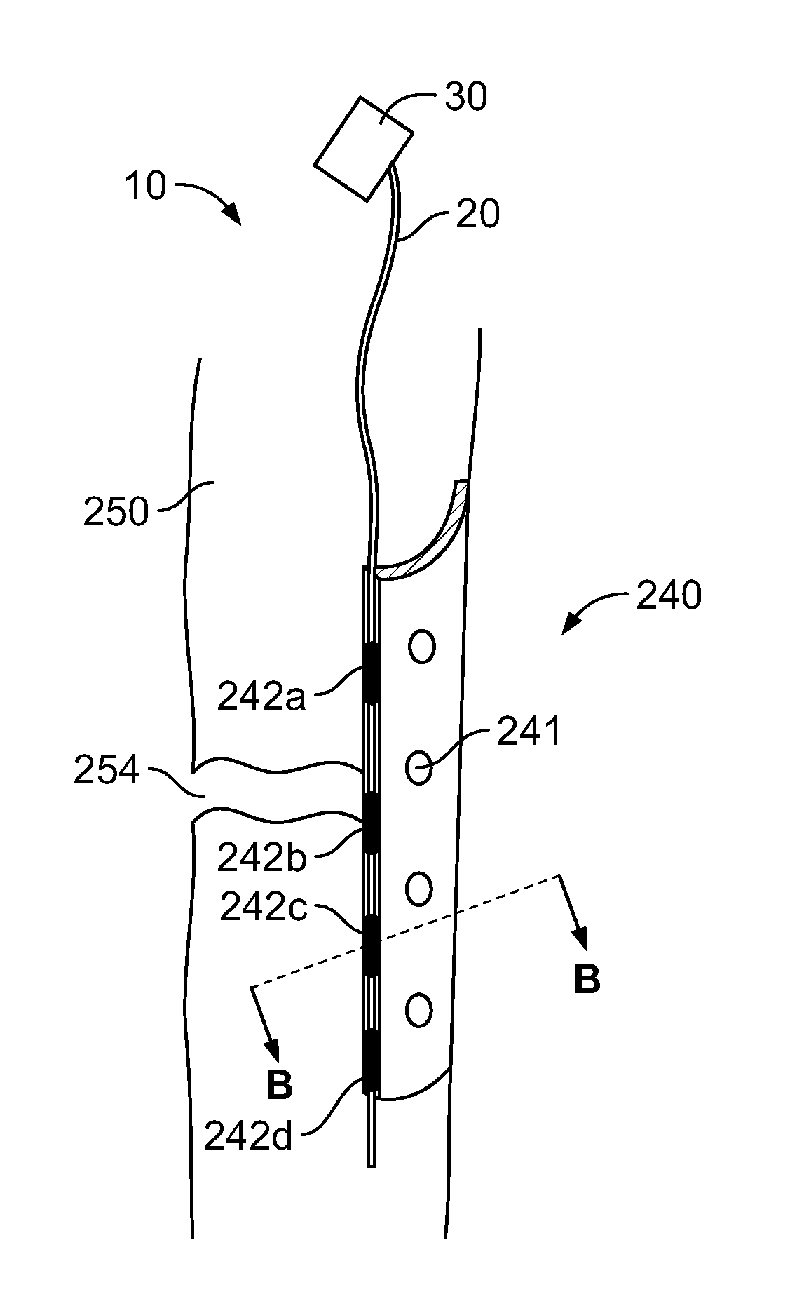 Bone healing probe