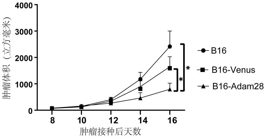 Preparation method and application of melanoma autologous tumor vaccine for high expression of ADAM-28