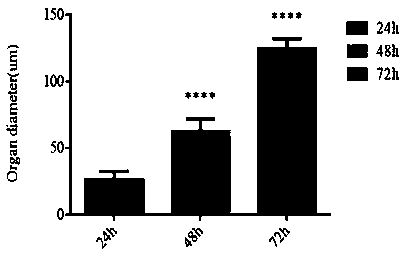 In vitro construction method of liver organs and applications