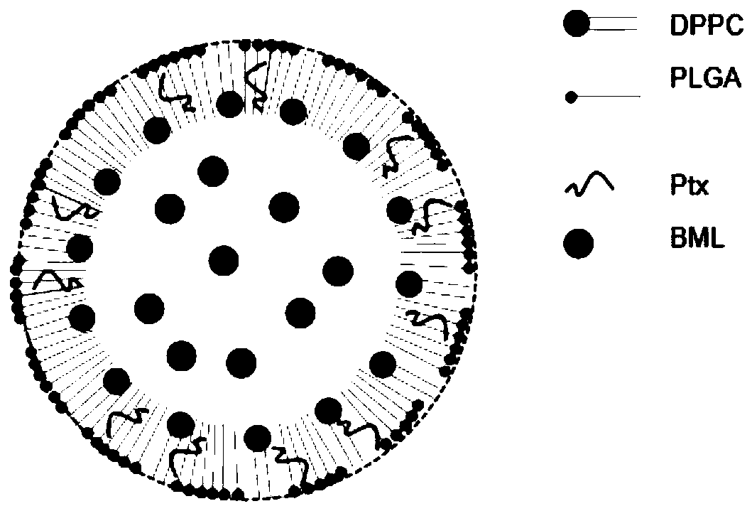 Nanoparticle for microwave touch release of PLGA shell, and preparation method and application of nanoparticle