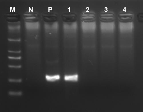 RDA (Recombinase-dependent amplification) method and kit for quickly detecting Coxsachie virus 16 and enterovirus 71