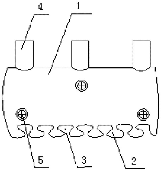 Mucoperiosteal type implant