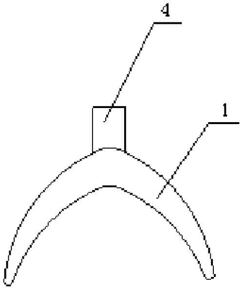 Mucoperiosteal type implant