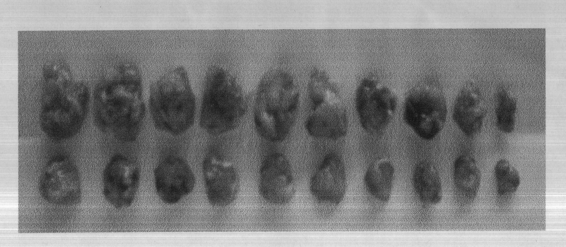 3,5-(E)-dibenzylidene-N-cyclopropyl piperidine-4-ketone and application of the 3,5-(E)-dibenzylidene-N-cyclopropyl piperidine-4-ketone in preparing antitumour drugs