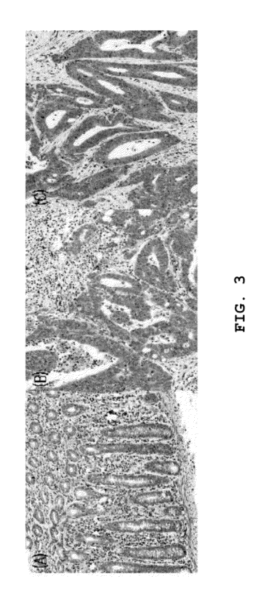 Composition for diagnosis of liver metastasis of colorectal cancer and the use thereof