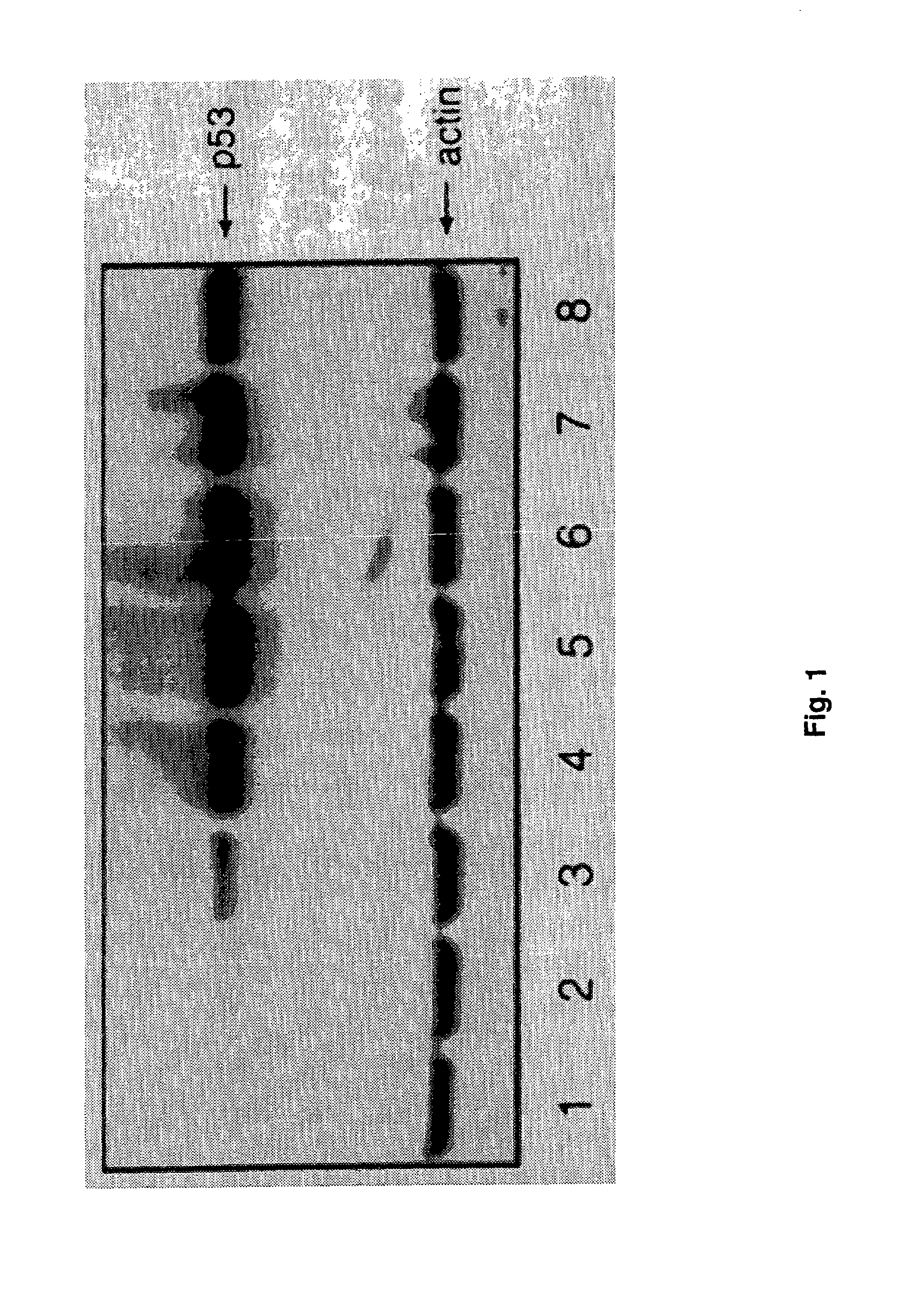 Gene therapy of tumors using non-viral delivery system