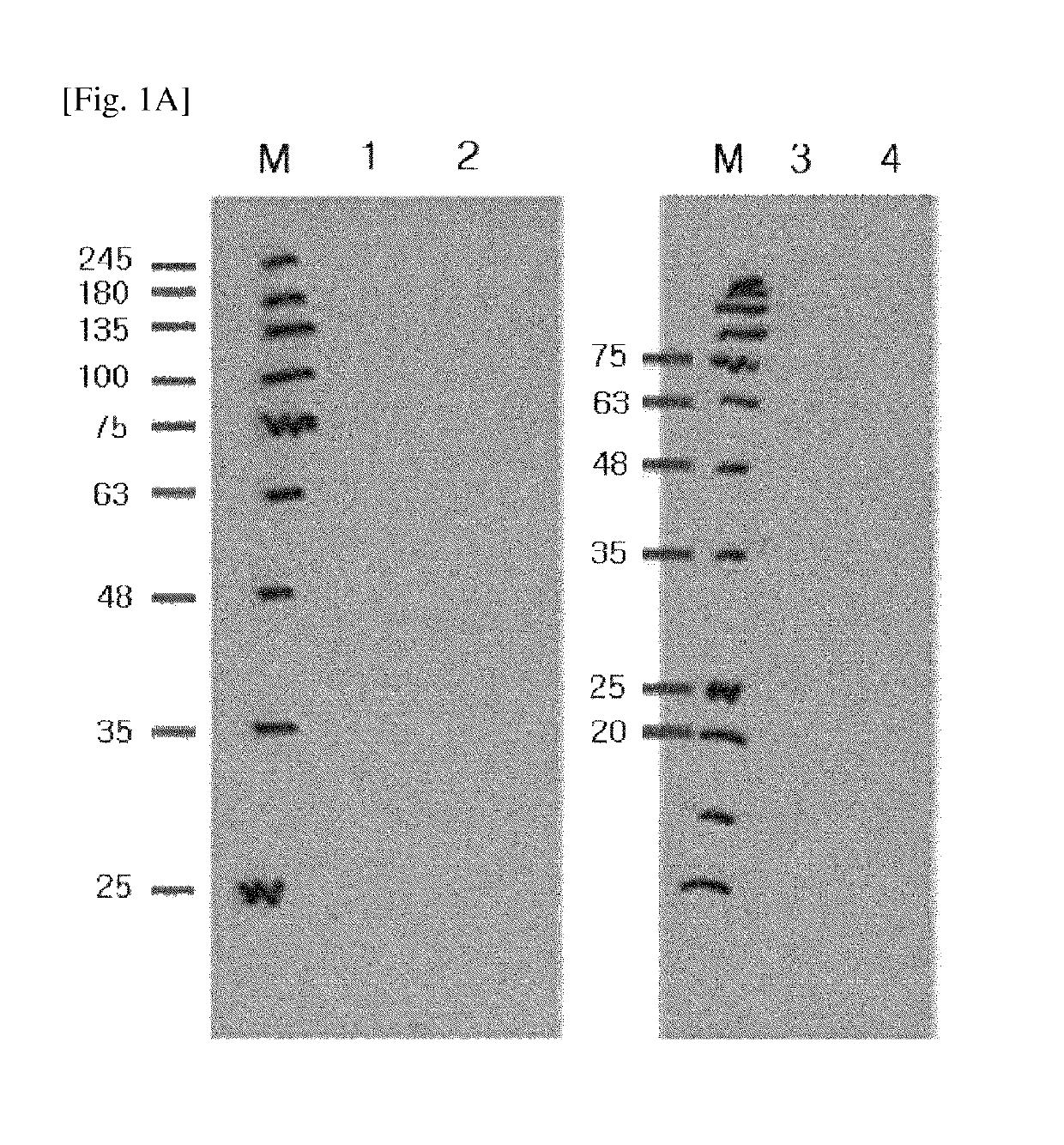 Modified DKK2 protein, nucleic acid encoding the same, preparation method thereof, and use thereof