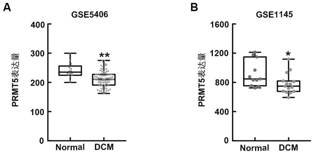 Construction method and application of dilated cardiomyopathy mouse model