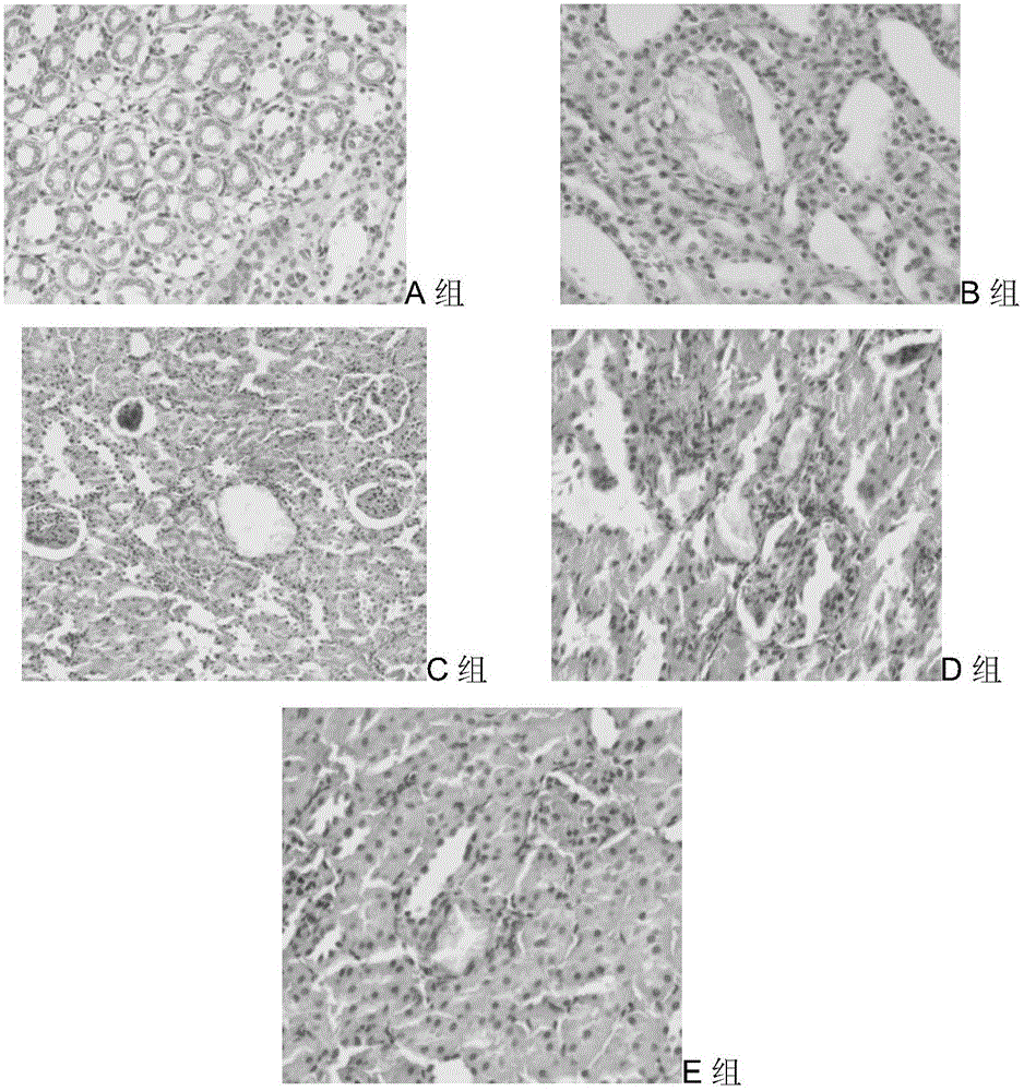 Composition for preventing urinary stone