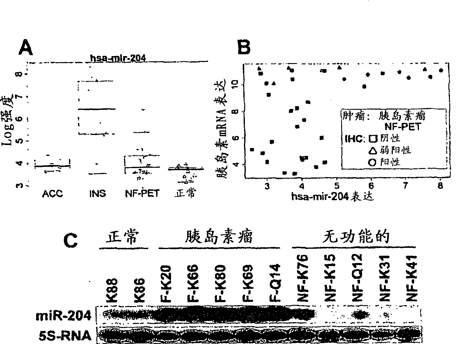 Microrna expression abnormalities in pancreatic endocrine and acinar tumors