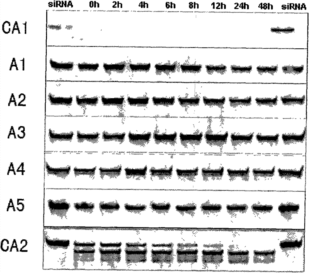 Small interfering nucleic acid and medical composite and pharmaceutical applications of nucleic acid