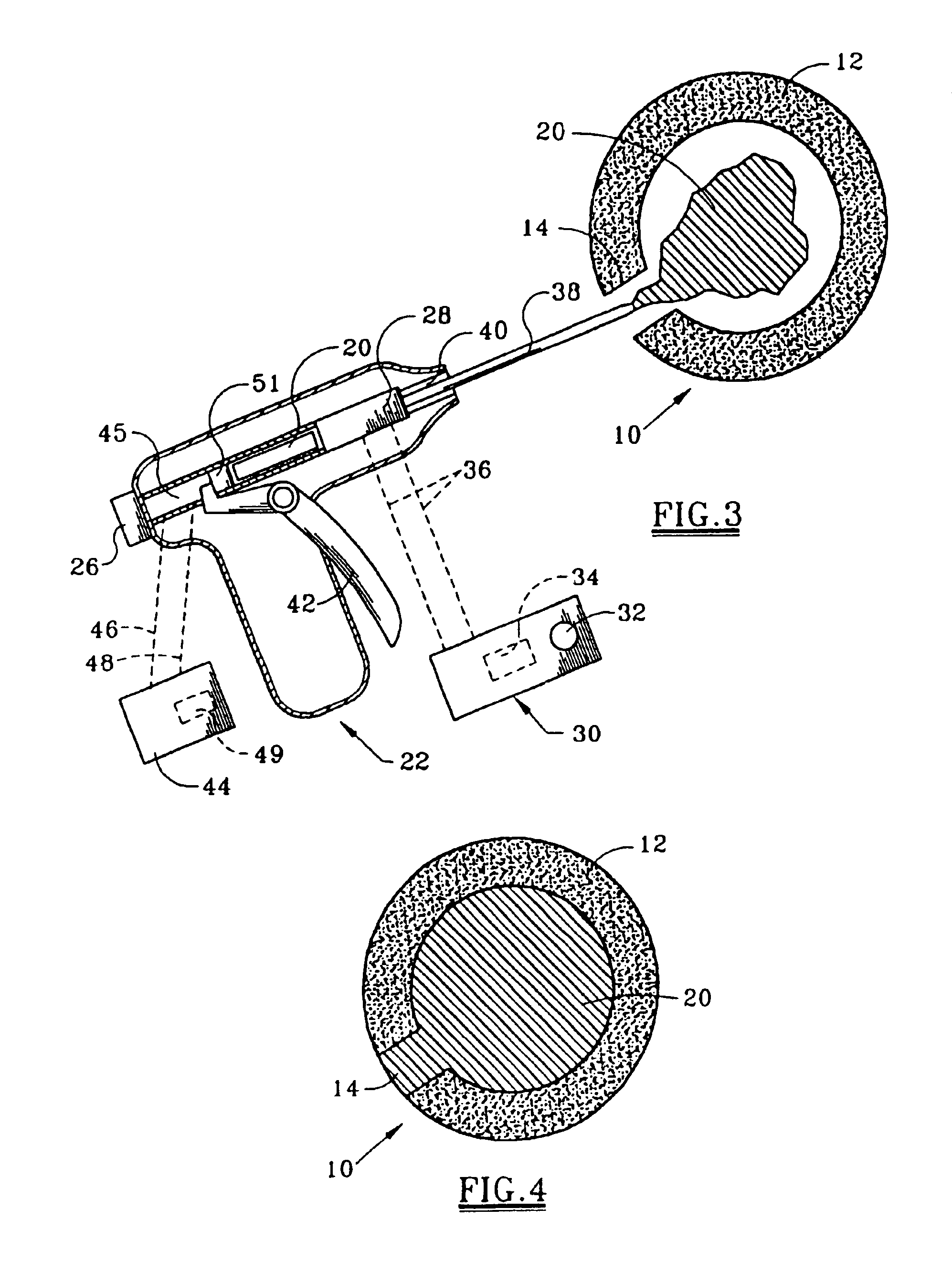 Method and apparatus for treating intervertebral disks