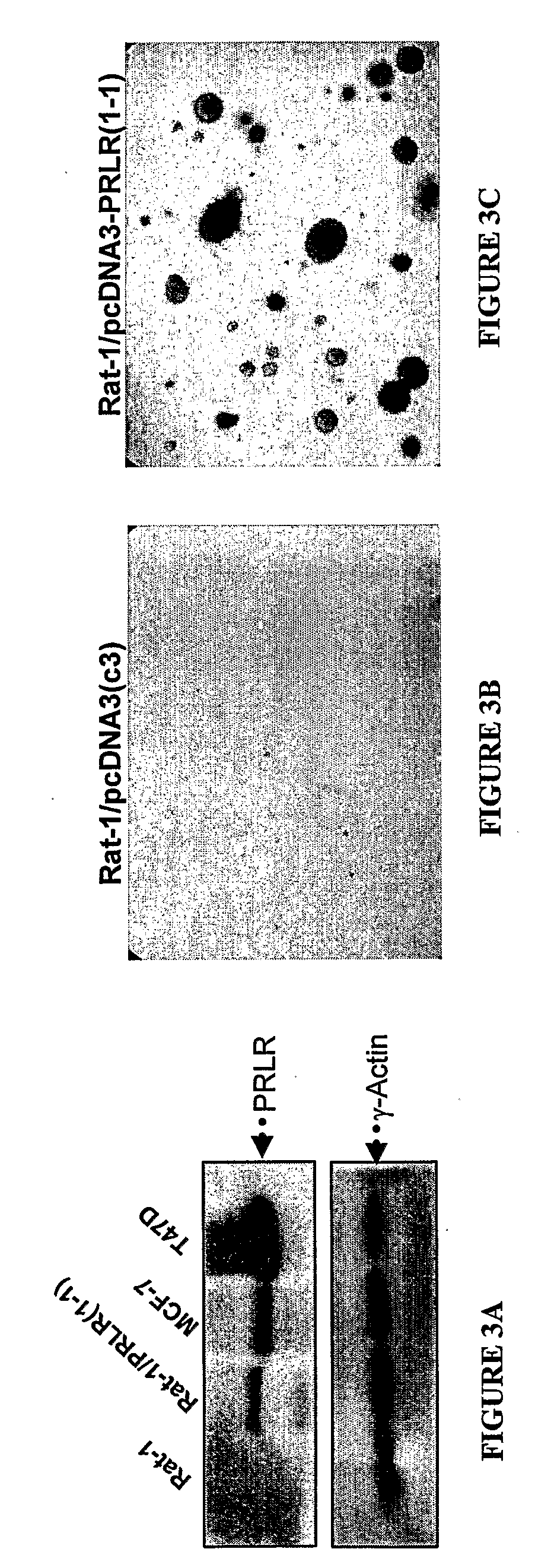 Cancer Related Genes (PRLR)