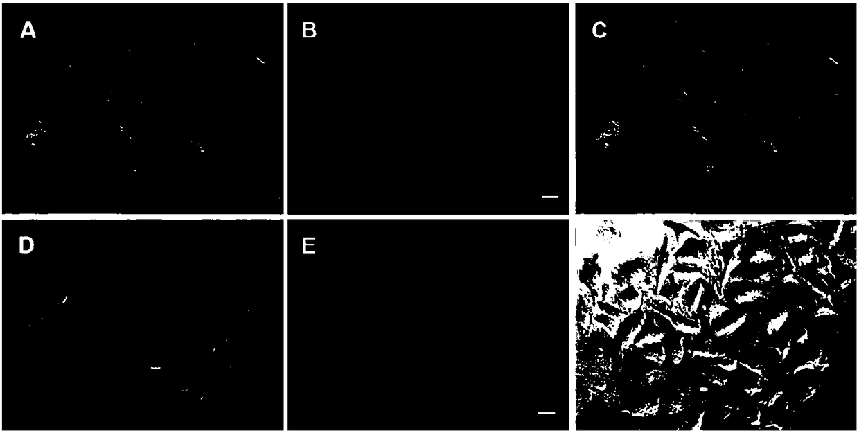 Ruthenium complex, ruthenium-RGD (arginine-glycine-aspartic acid) peptide conjugate and preparation method and application thereof