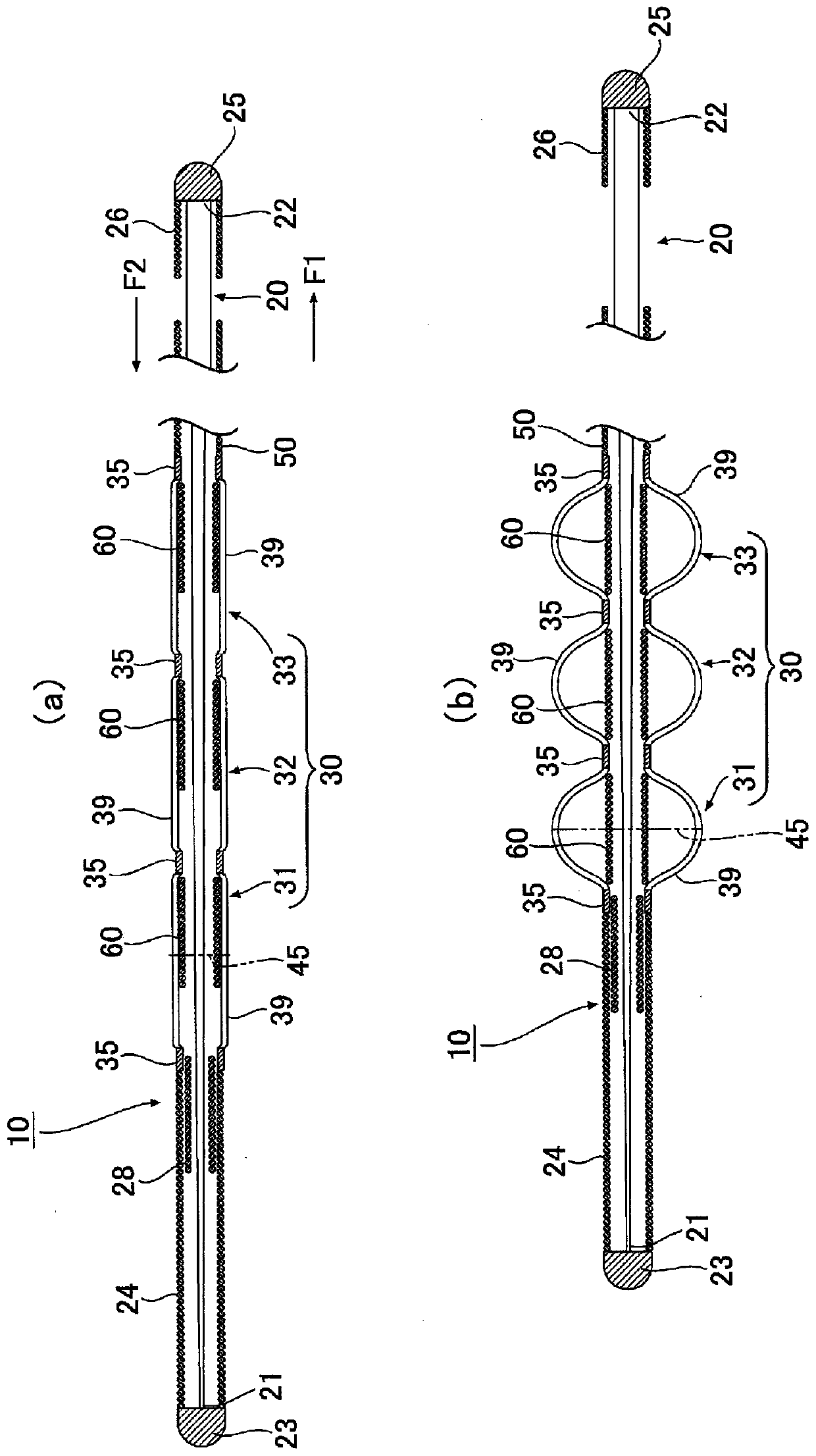 Intraluminal foreign object catching tool