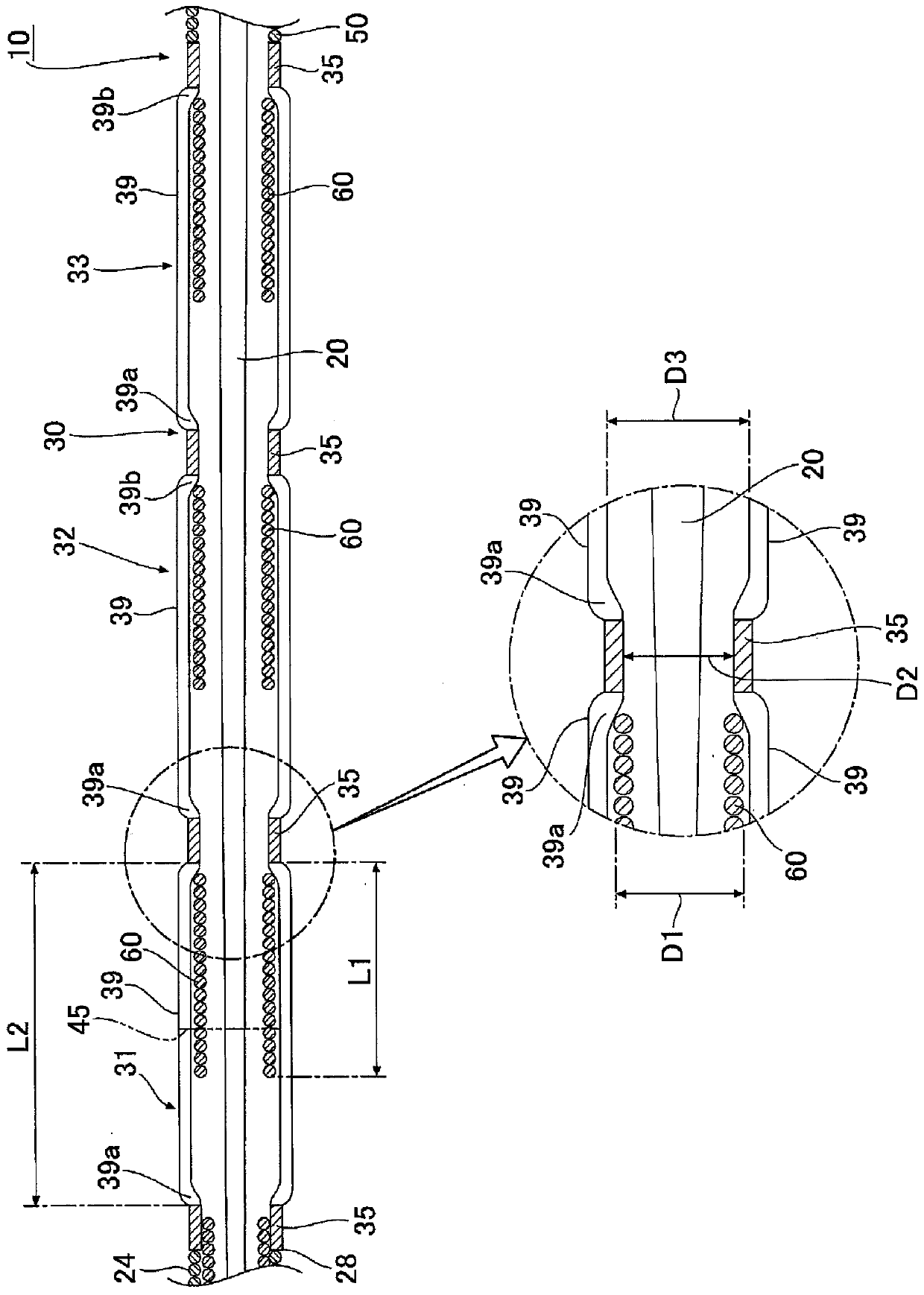 Intraluminal foreign object catching tool