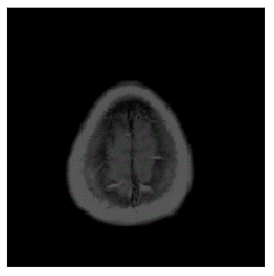 Method for encrypting medical image robust watermark based on DCT (Discrete Cosine Transform) ciphertext domain