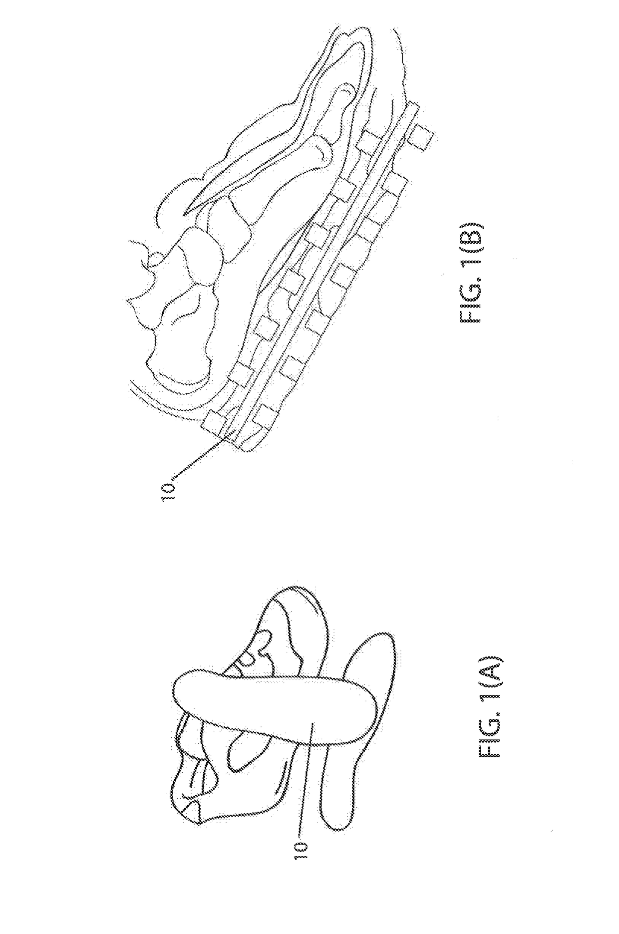 Pad Comprising an Extruded Mesh and Method of Making Thereof