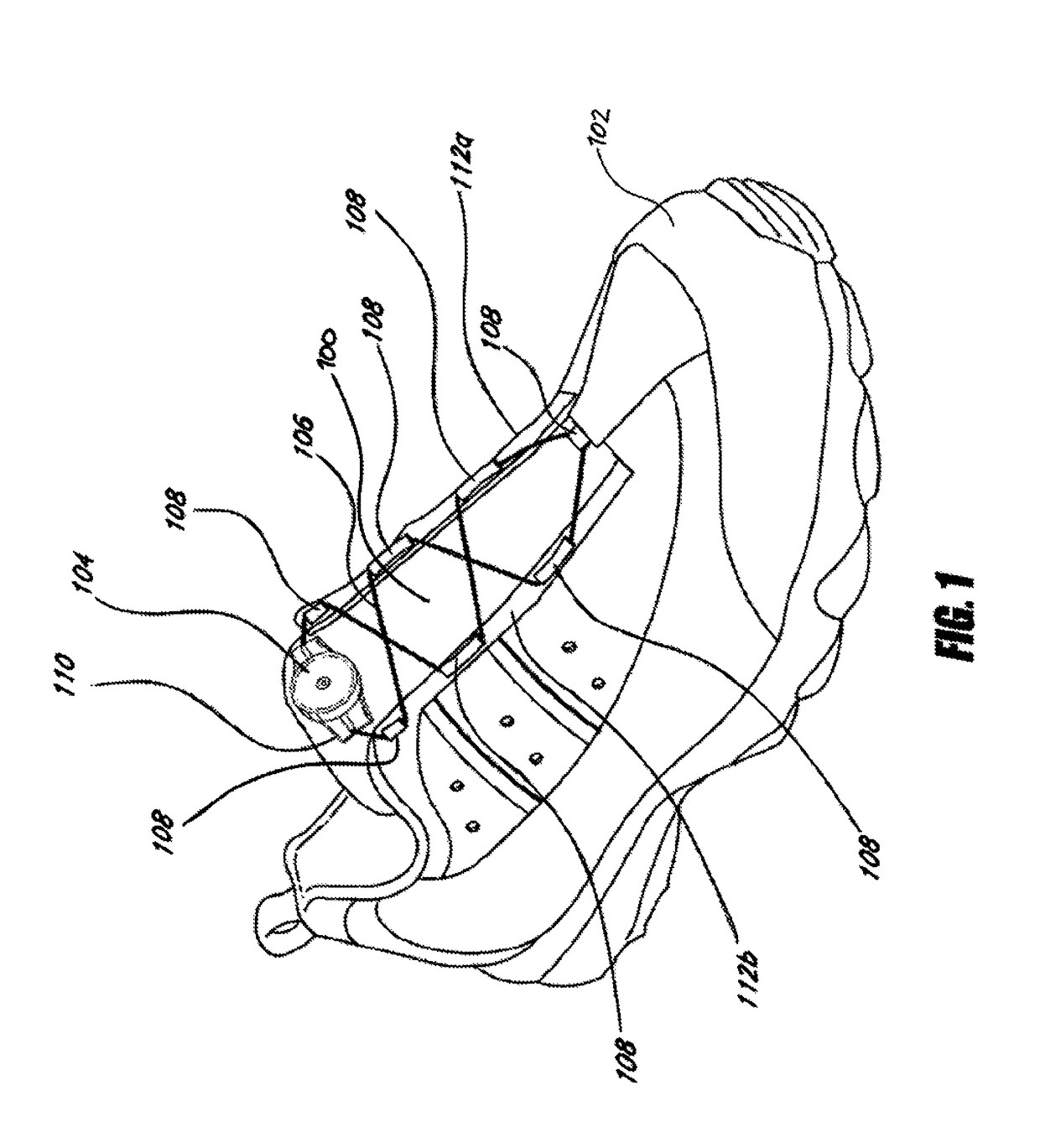 Guides and components for closure systems and methods therefor