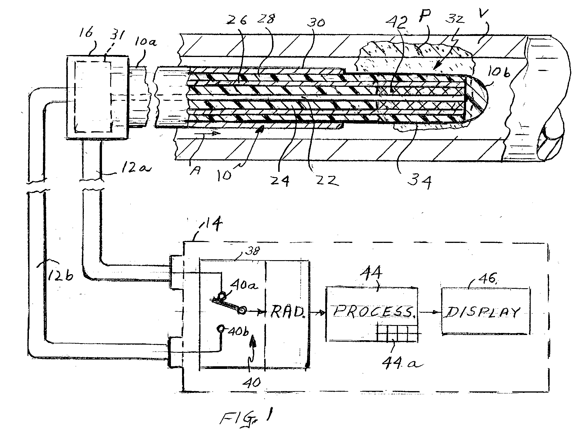 Method and apparatus for detecting and treating vulnerable plaques