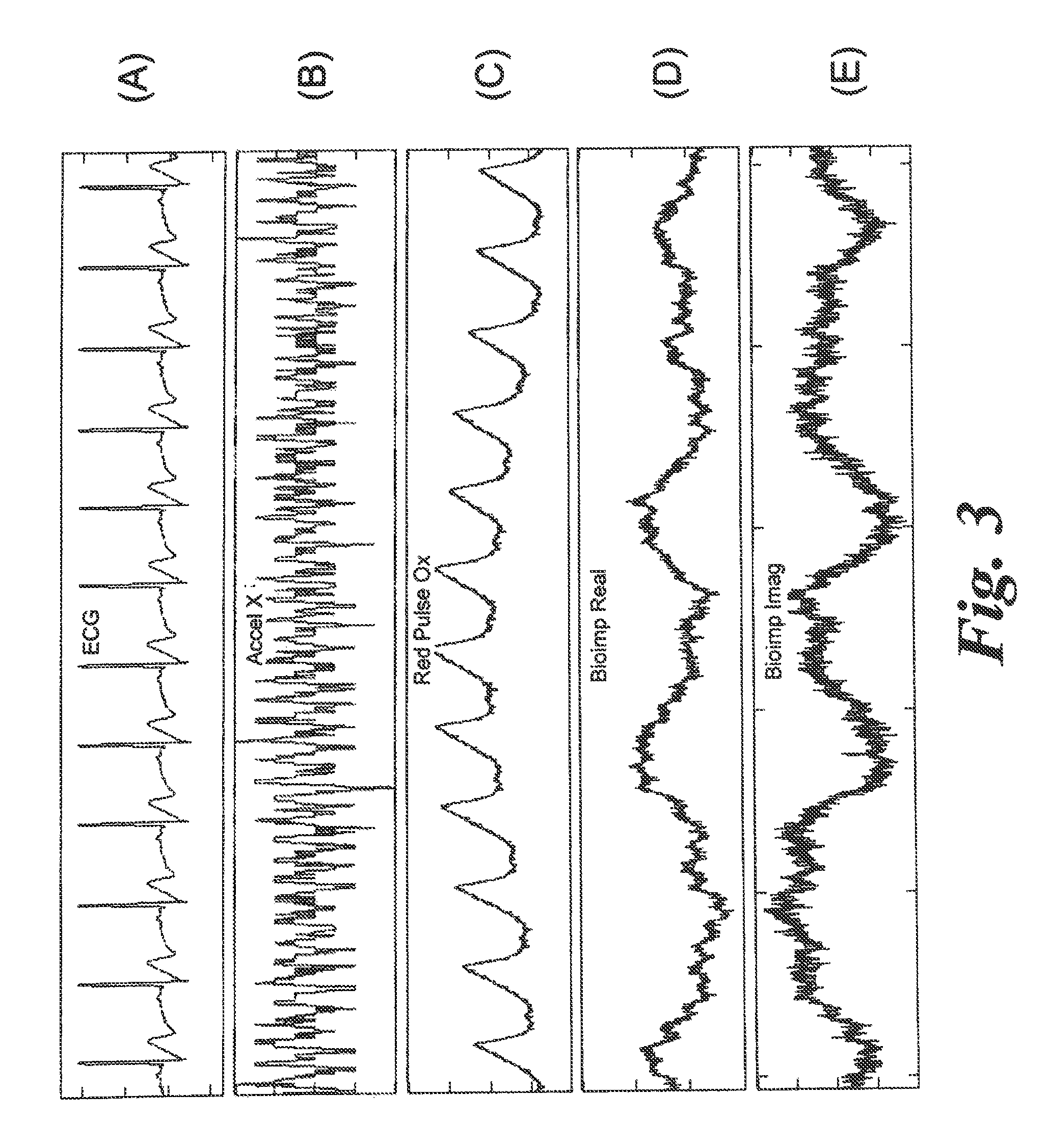 Multivariate residual-based health index for human health monitoring