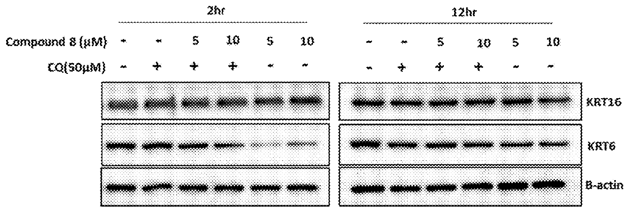 Novel autophagy activation-induced compound for improving skin inflammation for aging