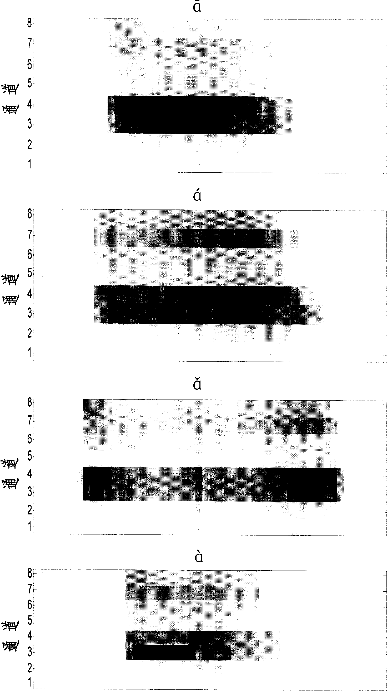 Electric cochlea Chinese fixed electric stimulation amplitude changing pattern in vitro voice processing equipment