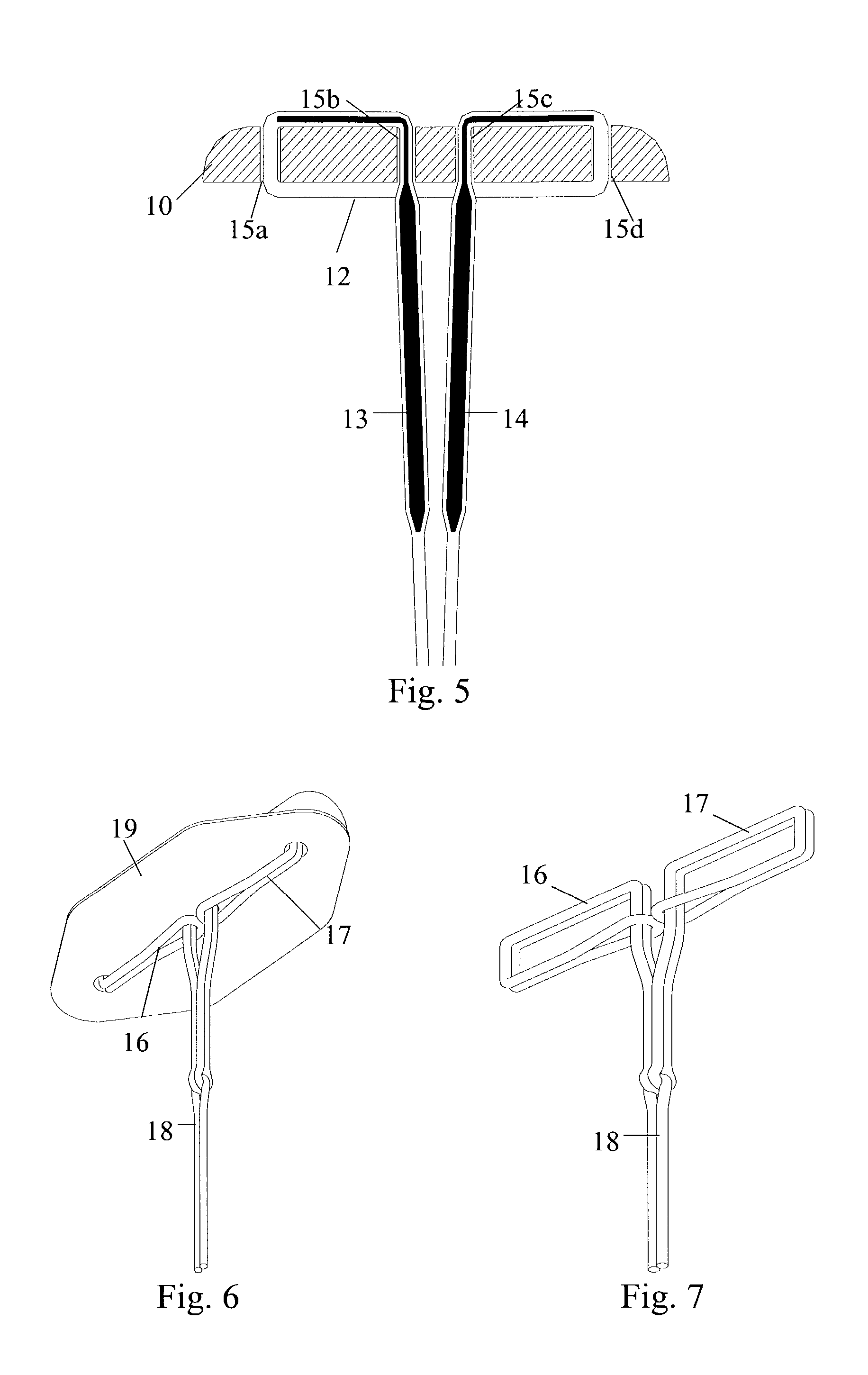 Absorbable medical sealing device with retaining assembly having at least two loops