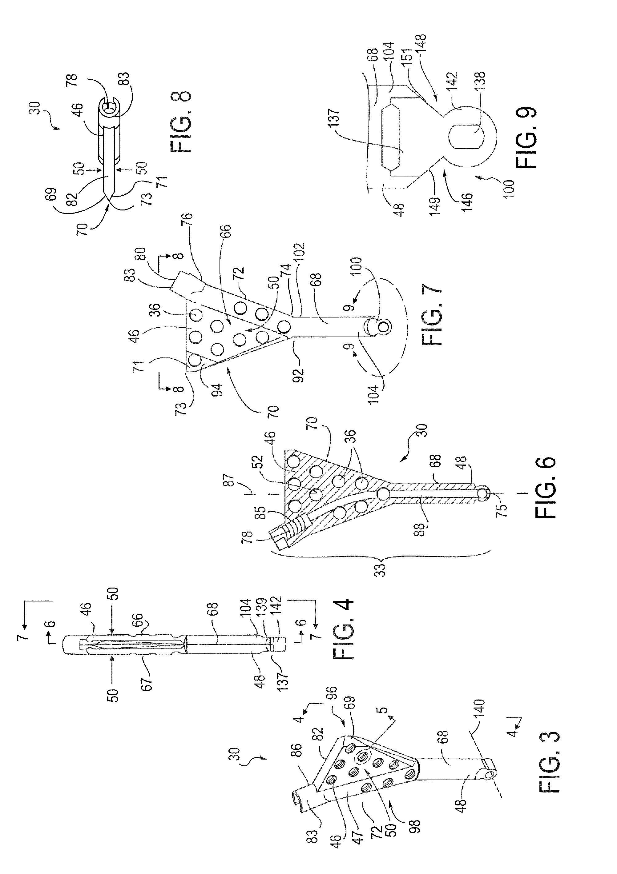 Percutaneous intramedullary bone repair device