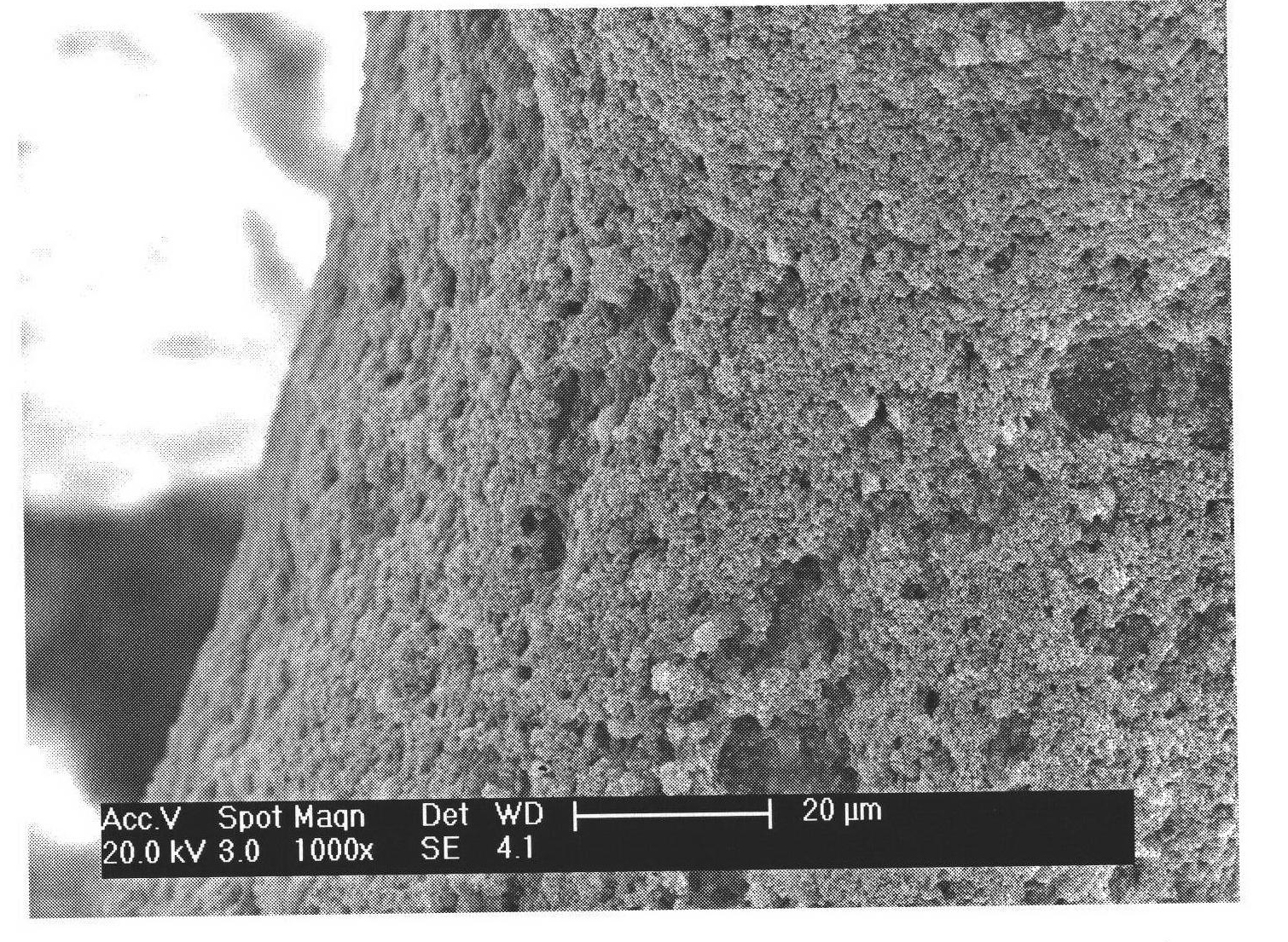 Preparation method of calcium phosphate ceramics/chitosan-hydroxyapatite composite coating porous material