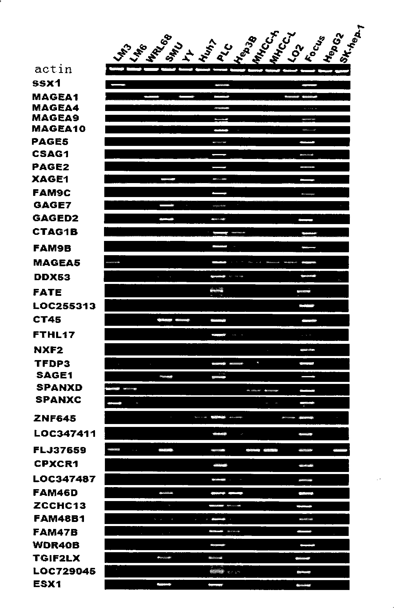 Uses of MAGEB6 gene