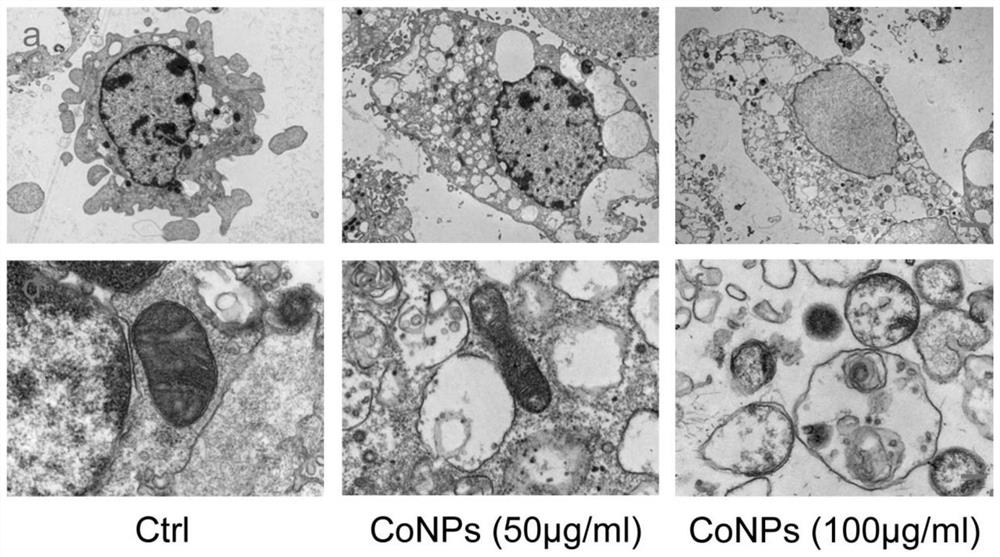 Application of Ferrostatin-1 in preparation of medicine for resisting periprosthetic osteolysis induced by wear particles of joint prosthesis