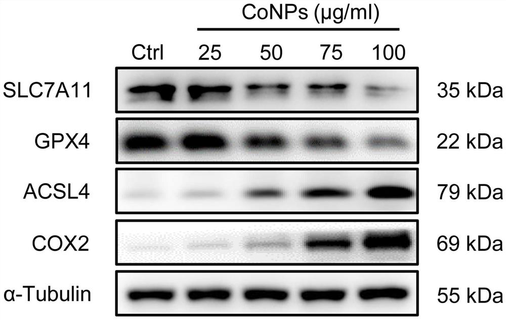 Application of Ferrostatin-1 in preparation of medicine for resisting periprosthetic osteolysis induced by wear particles of joint prosthesis