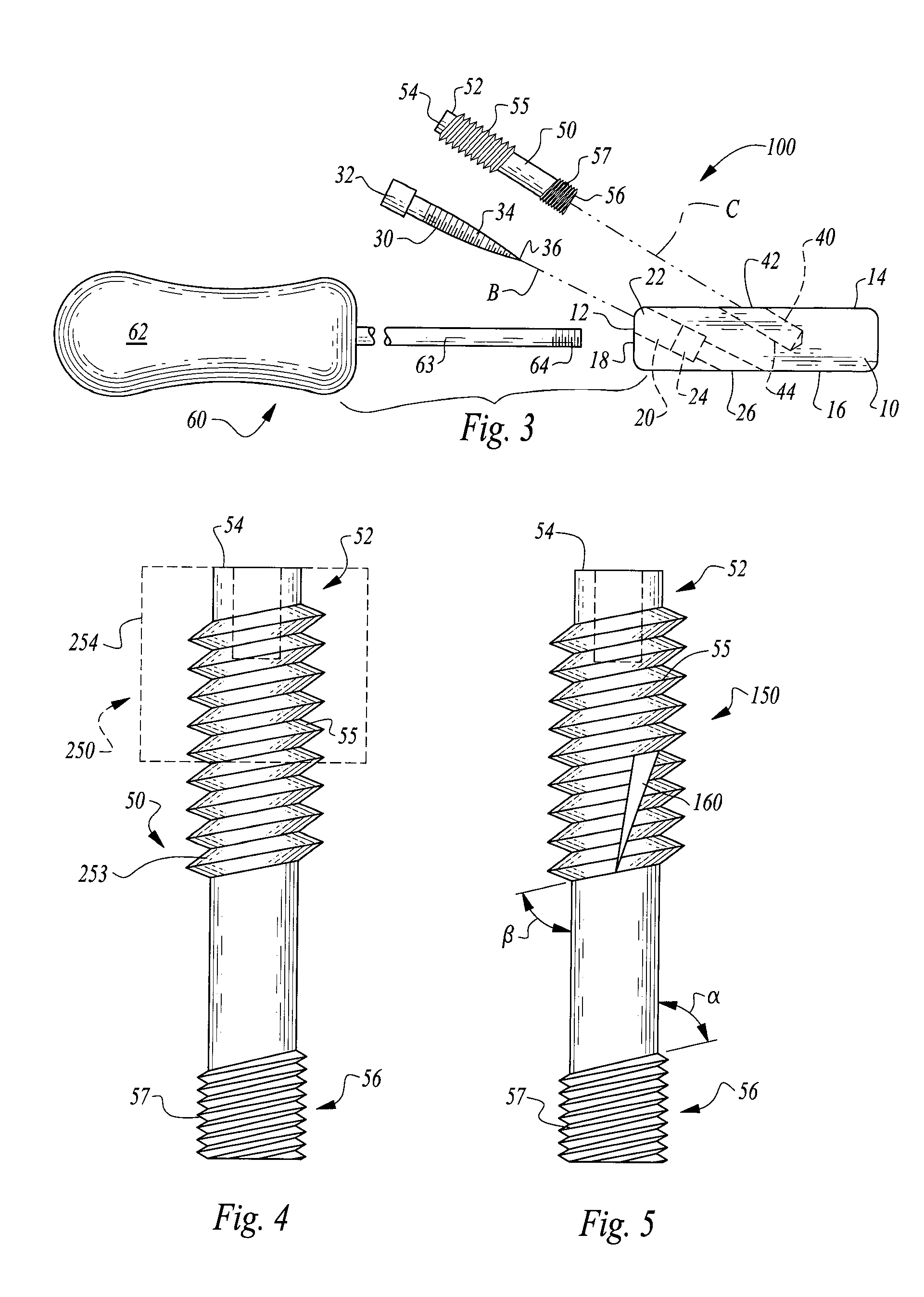 Interbody fusion implant and screw guide