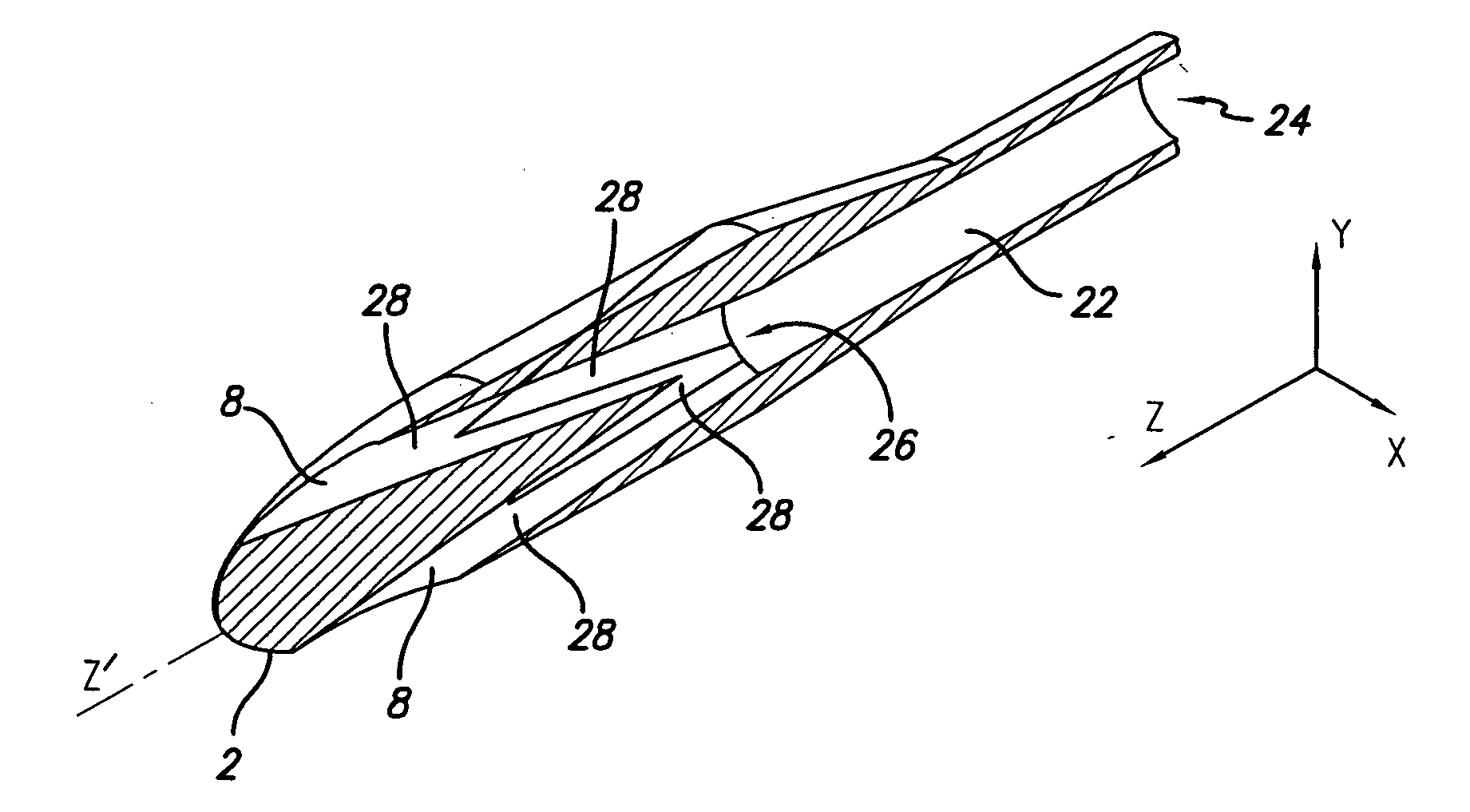 Reduction of recirculation in catheters